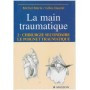 La main traumatique, tome 2