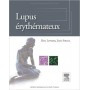 Lupus érythémateux