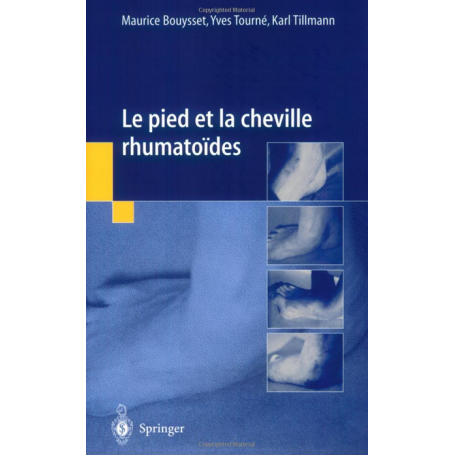 Le pied et la cheville rhumatoïdes