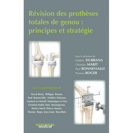 Révision des prothèses totales du genou : principes et stratégie