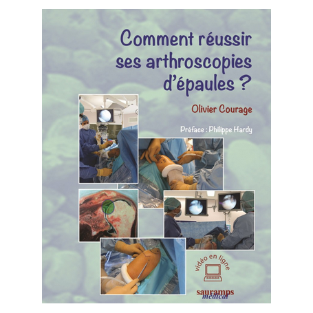 Comment réussir ses arthroscopies d'épaules ?