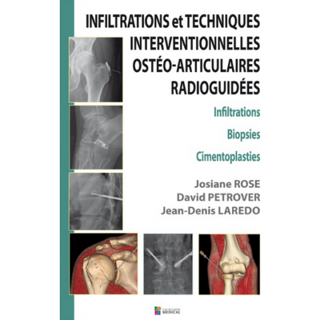 Infiltrations et techniques interventionnelles ostéo-articulaires radioguidées