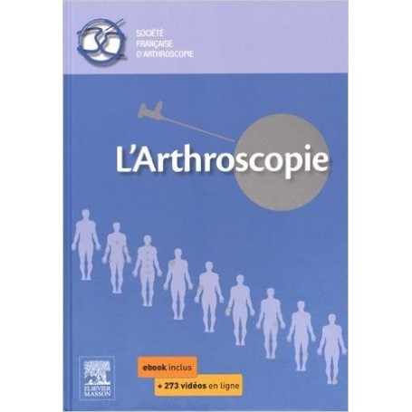 L'arthroscopie