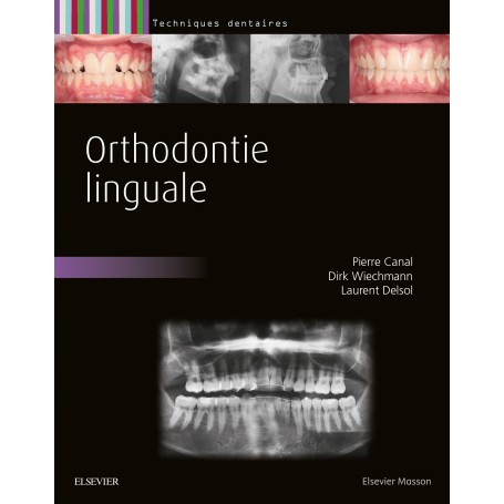 Orthodontie linguale