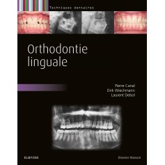 Orthodontie linguale