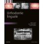 Orthodontie linguale