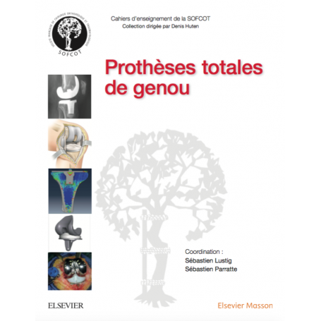 Prothèses totales de genou