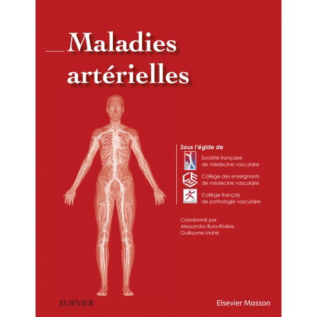 Maladies artérielles