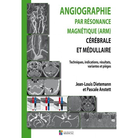 Angiographie par résonance magnétique cérébrale et médullaire