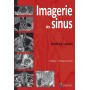 Imagerie des sinus