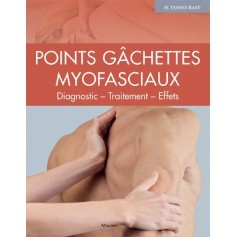 Points gâchettes myofasciaux