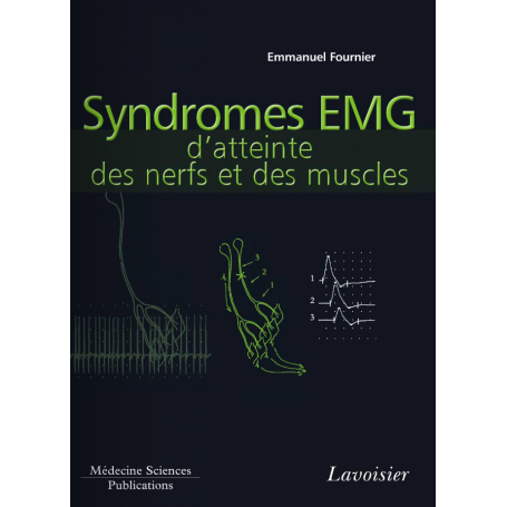 Syndromes EMG d'atteinte des nerfs et des muscles