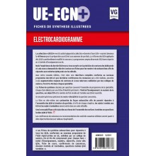 ECG