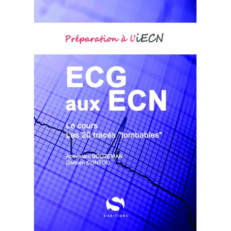 ECG aux ECN