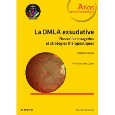 La DMLA exsudative