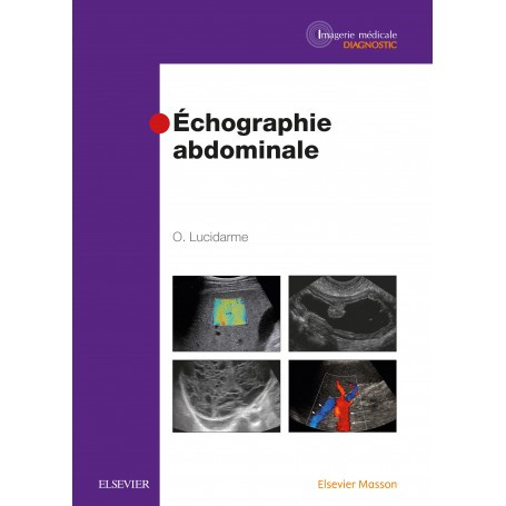 Echographie abdominale