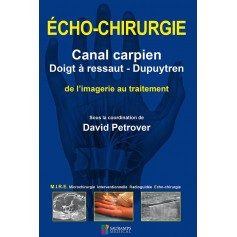 Echo-chirurgie : canal carpien