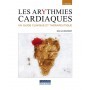 Les arythmies cardiaques