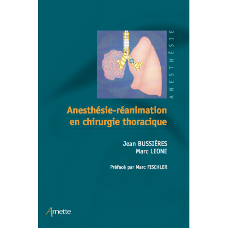 Anesthésie, Réanimation en Chirurgie thoracique