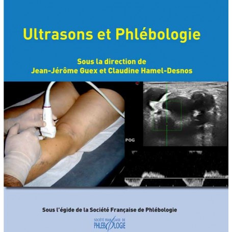 Ultrasons et phlébologie