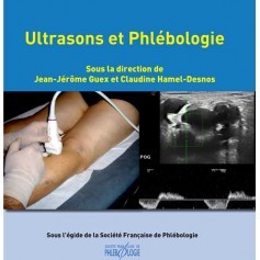 Ultrasons et phlébologie