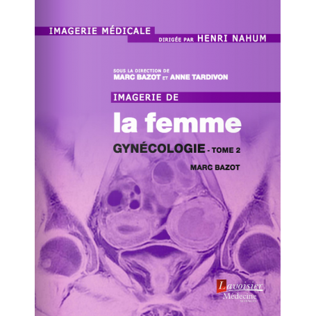 Imagerie de la femme : gynécologie, tome 2