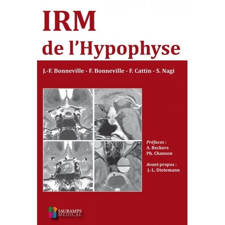 IRM de l'hypophyse