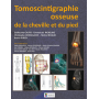 Tomoscintigraphie osseuse de la cheville et du pied