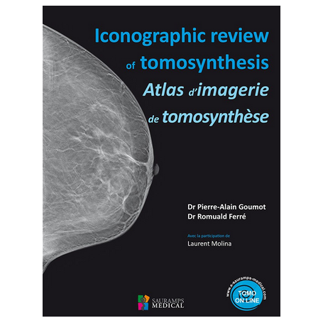 Atlas d'imagerie de tomosynthèse