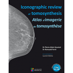 Atlas d'imagerie de tomosynthèse