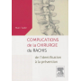 Complications de la chirurgie du rachis