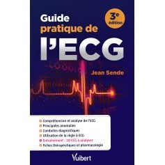 Guide pratique de l'ECG