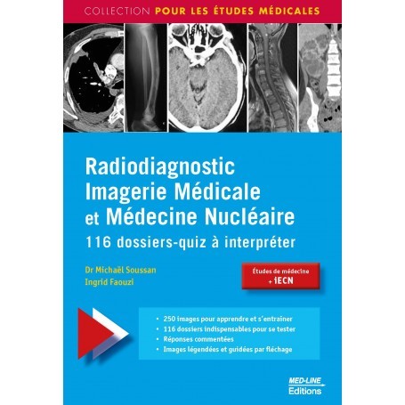 Radiodiagnostic, imagerie médicale et médecine nucléaire