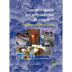 Comment réussir ses arthroscopies de poignet ?