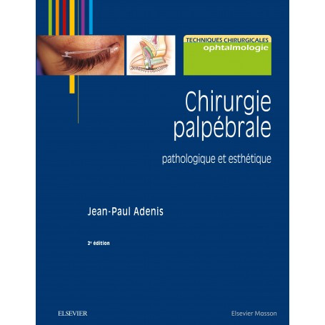 Chirurgie palpébrale