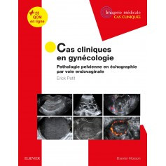 Cas cliniques en gynécologie