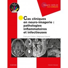 Cas cliniques en neuro-imagerie : pathologies inflammatoires et infectieuses