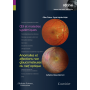Oeil et maladies systémiques, anomalies et affections non glaucomateuses du nerf optique