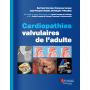 Cardiopathies valvulaires de l'adulte