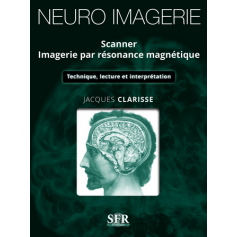 Neuro-imegerie : scanner, imagerie par résonance magnétique