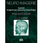 Neuro-imagerie : scanner, imagerie par résonance magnétique