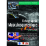 Echographie musculosquelettique