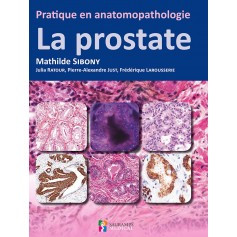 Pratique en anatomopathologie : la prostate