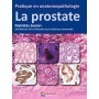 La prostate : pratique en anatomopathologie