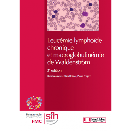 Leucémie lymphoïde chronique et macroglobulinémie de Waldenström