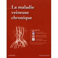 La maladie veineuse chronique