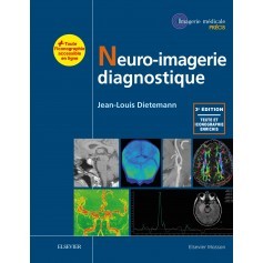 Neuro-imagerie diagnostique