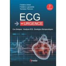 ECG en urgence