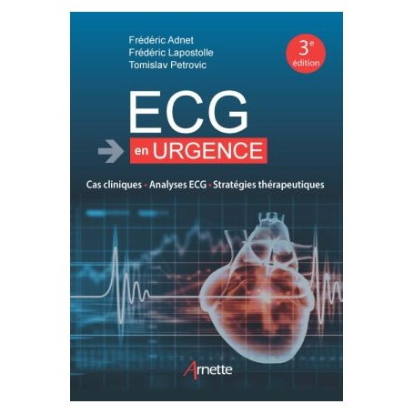 ECG en urgence