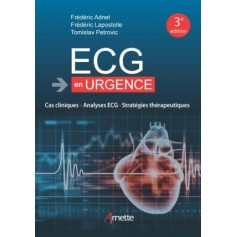 ECG en urgence